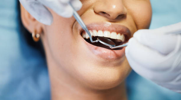 Best Teeth Whitening  in Kingsford, MI